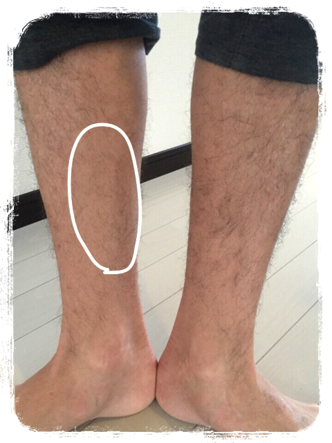 みきてぃ×ゼロクリーン