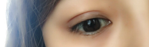 みきてぃ×ミセルDラインジェル