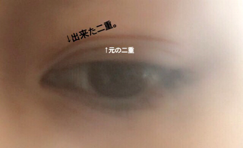 みきてぃ×ミセルDラインジェル