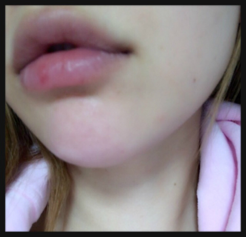 @GIRL_ﾎﾜｲﾃｽﾄﾌﾟﾗｾﾝﾀｴｷｽ原液_ちいめろ