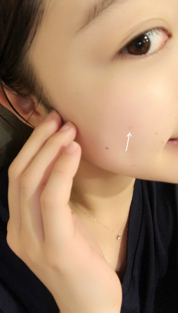 ＠GIRL_ﾌｧﾝｹﾙｱｸﾈｹｱ_miku