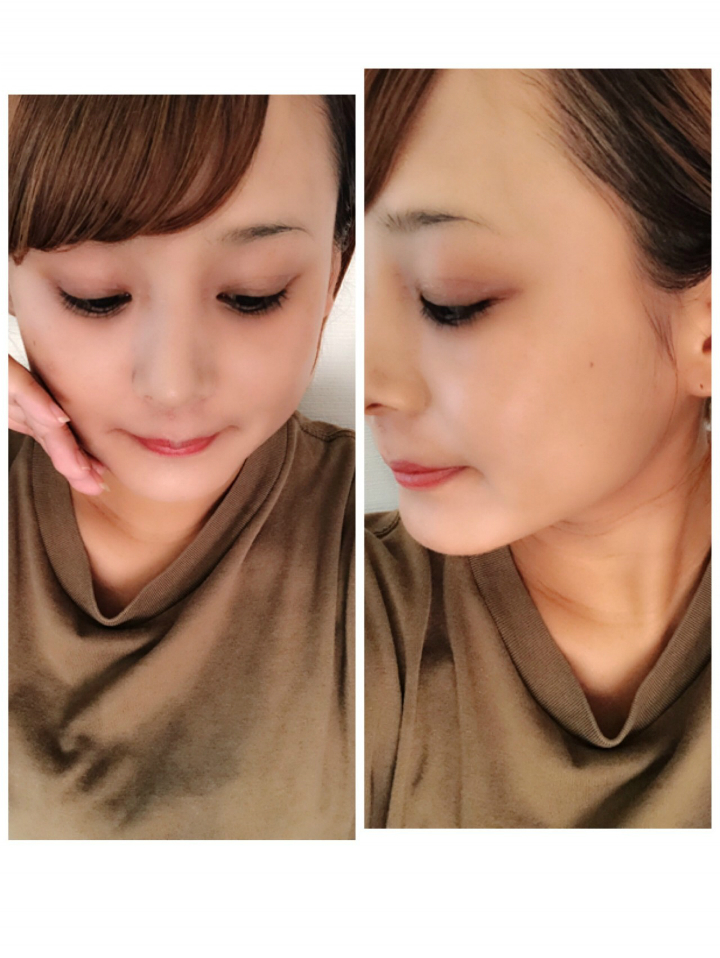 ＠GIRL_資生堂ｱﾚﾙﾊﾞﾘｱﾐｽﾄ_みきてぃ