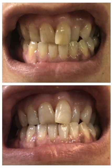 @GIRL_薬用ﾊﾟｰﾙﾎﾜｲﾄﾌﾟﾛEXﾌﾟﾗｽ_miku