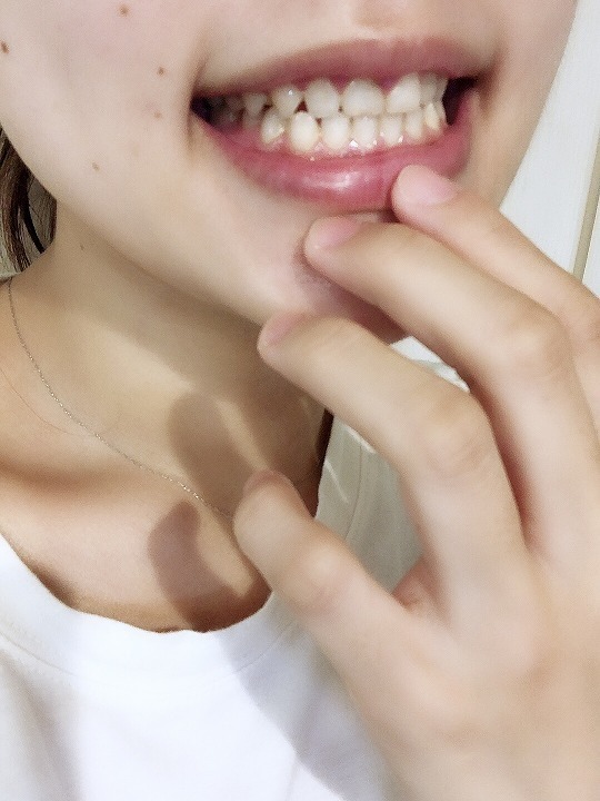 @GIRL_薬用ﾊﾟｰﾙﾎﾜｲﾄﾌﾟﾛEXﾌﾟﾗｽ_miku