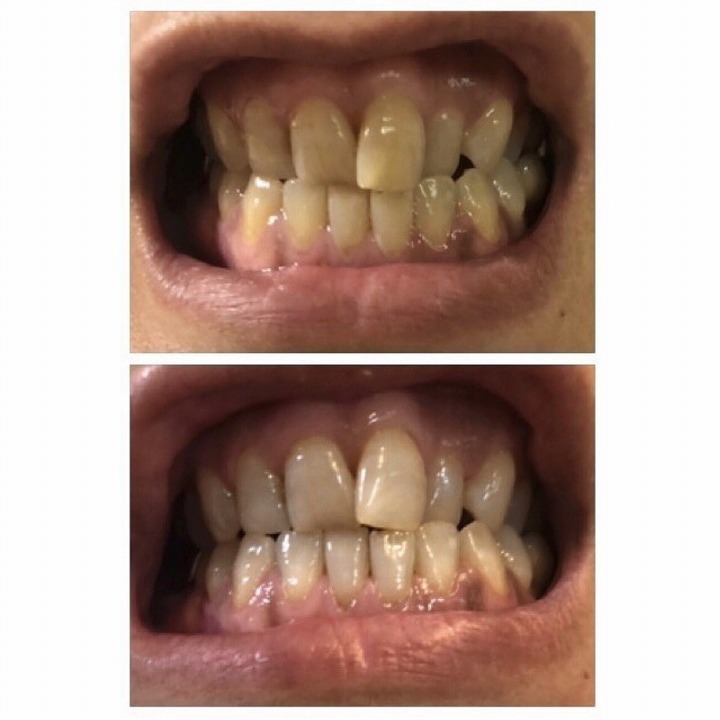 @GIRL_薬用ﾊﾟｰﾙﾎﾜｲﾄﾌﾟﾛEXﾌﾟﾗｽ_miku