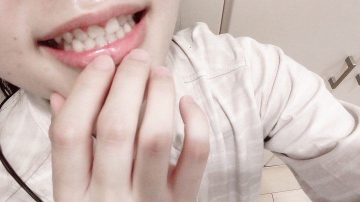 @GIRL_薬用ﾊﾟｰﾙﾎﾜｲﾄﾌﾟﾛEXﾌﾟﾗｽ_miku