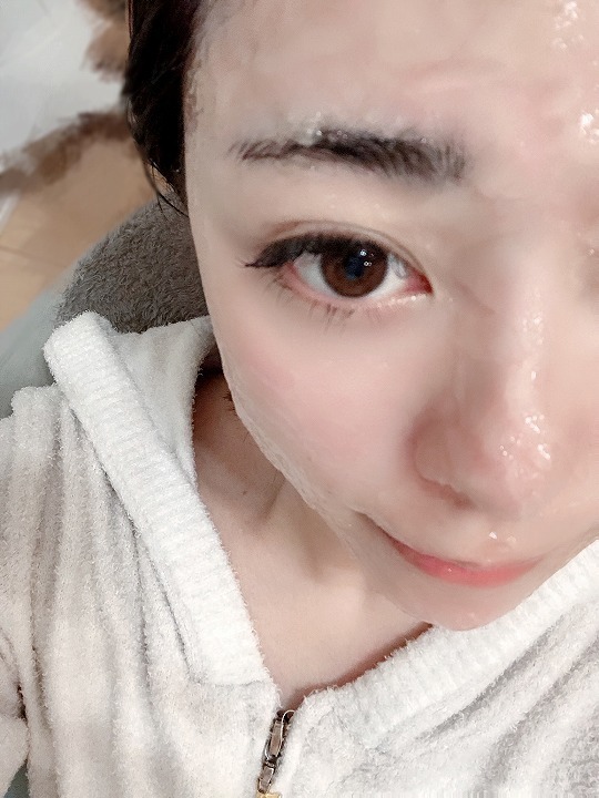 @GIRL_ﾅﾉｱｸｱ 炭酸ｼﾞｪﾙﾊﾟｯｸ_miku