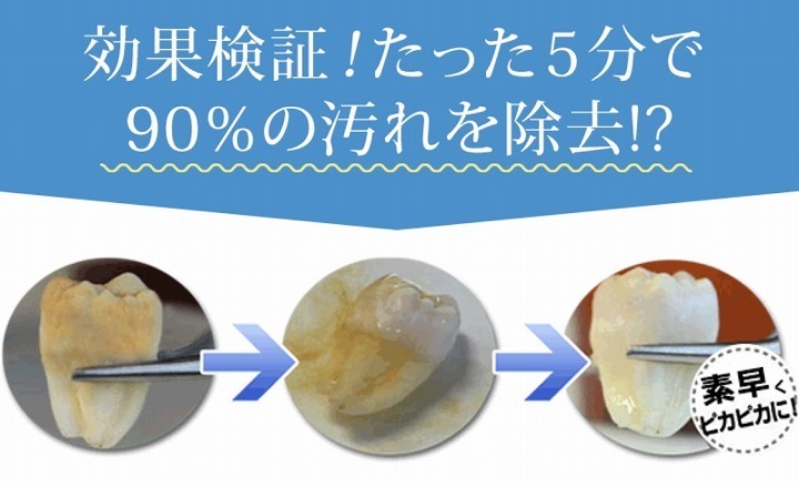 @GIRL_薬用ﾊﾟｰﾙﾎﾜｲﾄﾌﾟﾛEXﾌﾟﾗｽ_miku