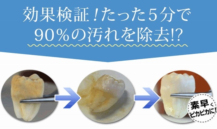 @GIRL_薬用ﾊﾟｰﾙﾎﾜｲﾄﾌﾟﾛEXﾌﾟﾗｽ_miku