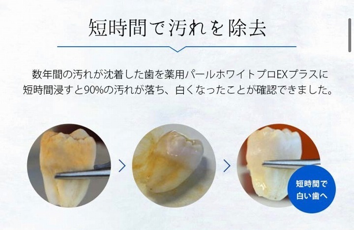 @GIRL_薬用ﾊﾟｰﾙﾎﾜｲﾄﾌﾟﾛEXﾌﾟﾗｽ_miku