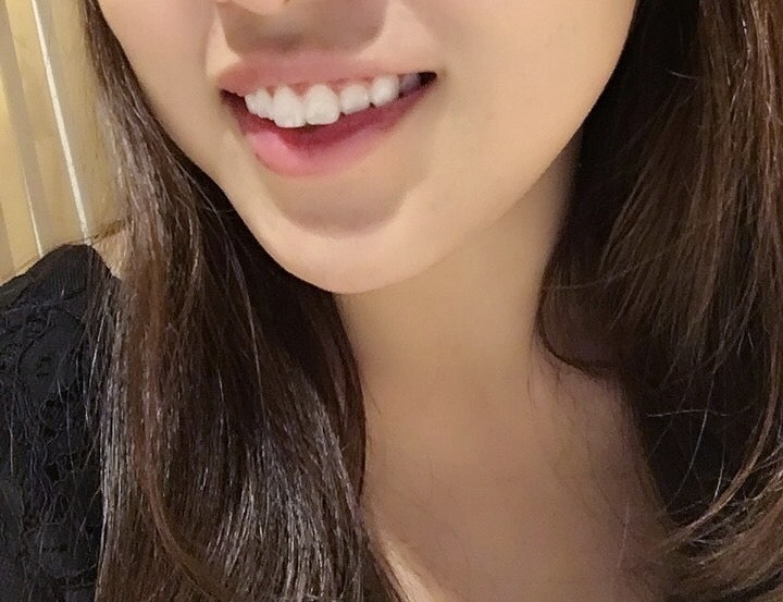 @GIRL_薬用ﾊﾟｰﾙﾎﾜｲﾄﾌﾟﾛEXﾌﾟﾗｽ_まゆまゆ