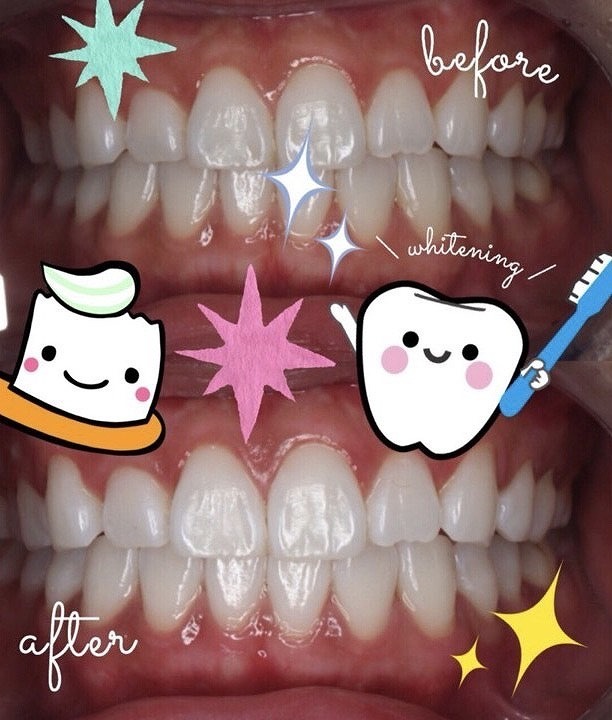 @GIRL_薬用ﾊﾟｰﾙﾎﾜｲﾄﾌﾟﾛEXﾌﾟﾗｽ_まゆまゆ