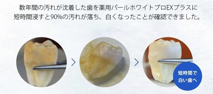 @GIRL_薬用ﾊﾟｰﾙﾎﾜｲﾄﾌﾟﾛEXﾌﾟﾗｽ_miku