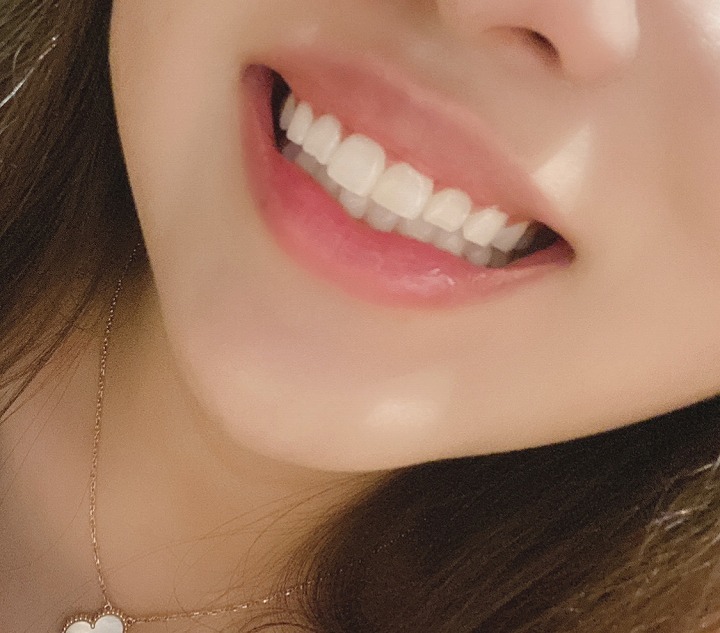 @GIRL_薬用ﾊﾟｰﾙﾎﾜｲﾄﾌﾟﾛEXﾌﾟﾗｽ_まゆまゆ