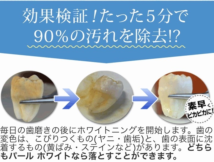 @GIRL_薬用ﾊﾟｰﾙﾎﾜｲﾄﾌﾟﾛEXﾌﾟﾗｽ_miku