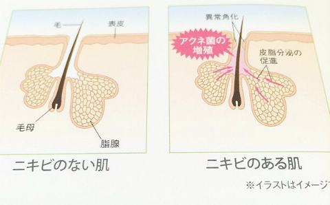 アユ×ファーストクラッシュ