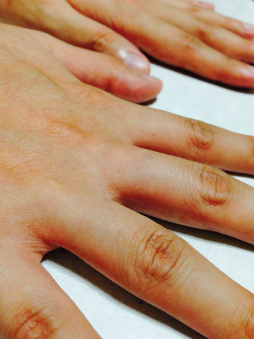 みくぽん×ｾﾞﾛｸﾘｰﾝ