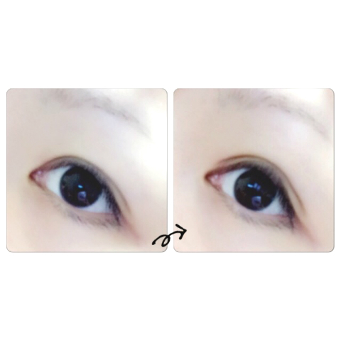 アユ×ミセルD-ラインジェル