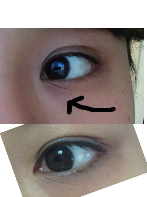 みきてぃ×プラセンタエクストラクト