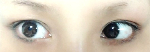 みきてぃ×ミセルDラインジェル