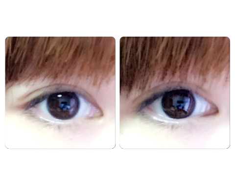 アユ×ミセルDラインジェル