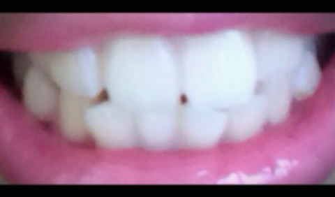 ちいめろ×薬用Perl White