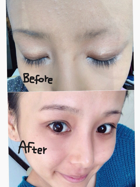 みきてぃ×プラセンタエクストラクト