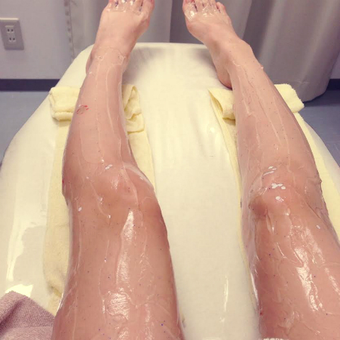 おまめ×脱毛ラボ