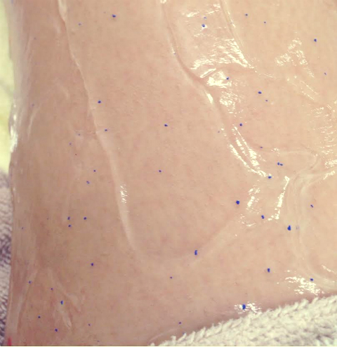 おまめ×脱毛ラボ