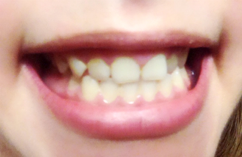 みくぽん×薬用Perl White