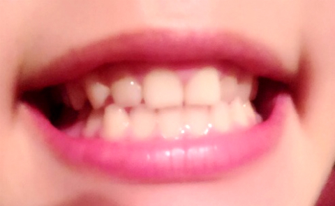 みくぽん×薬用Perl White