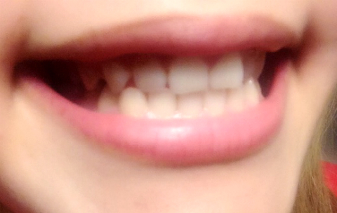 みくぽん×薬用Perl White