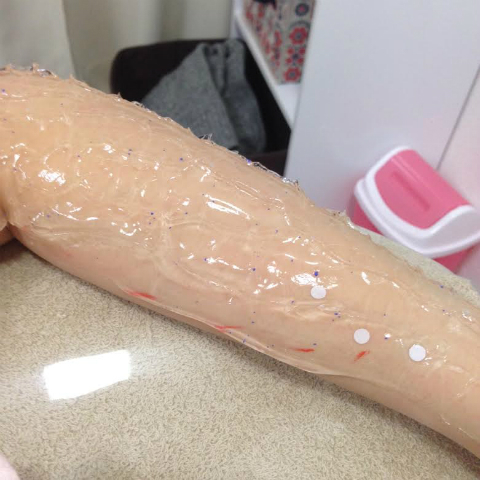 おまめ×脱毛ラボ