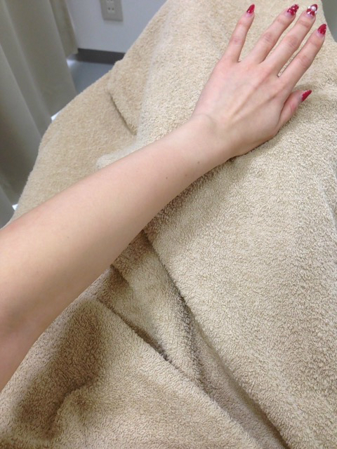 おまめ×脱毛ラボ