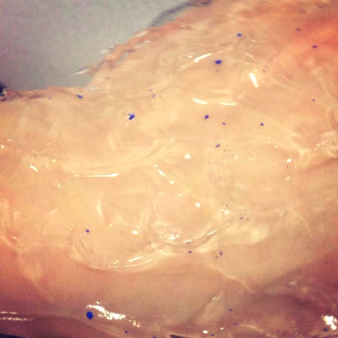 おまめ×脱毛ラボ