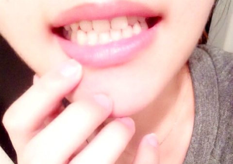 miku×薬用 Pearl White Pro EX