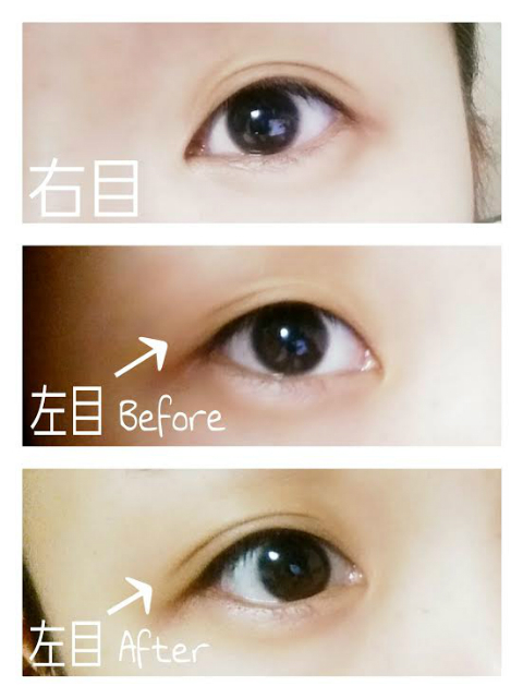 TaMokitty×ミセルDラインジェル