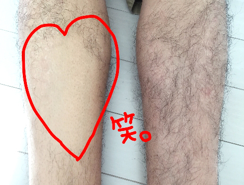 みきてぃ×ゼロクリーン