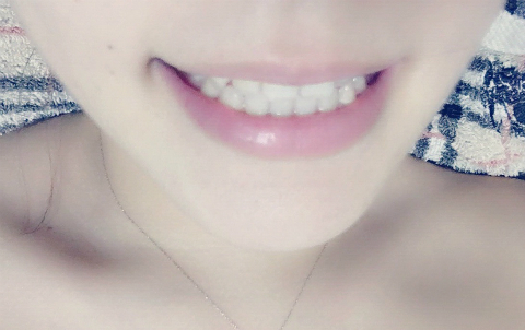 miku×薬用パールホワイトproEX